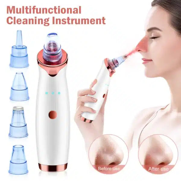 Vacuum Blackhead Remover Fac