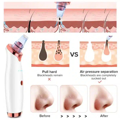 Vacuum Blackhead Remover Fac